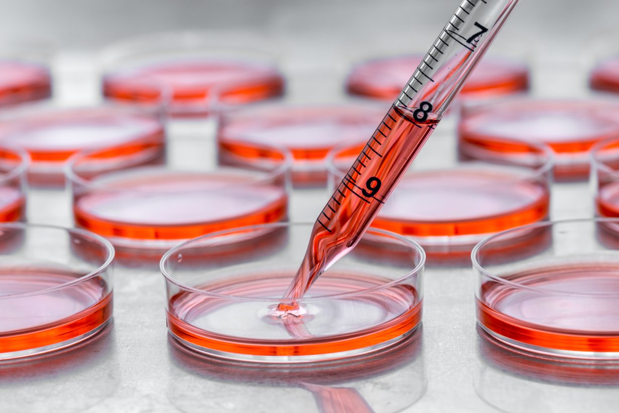 Cell culture media identification in biopharmaceuticals